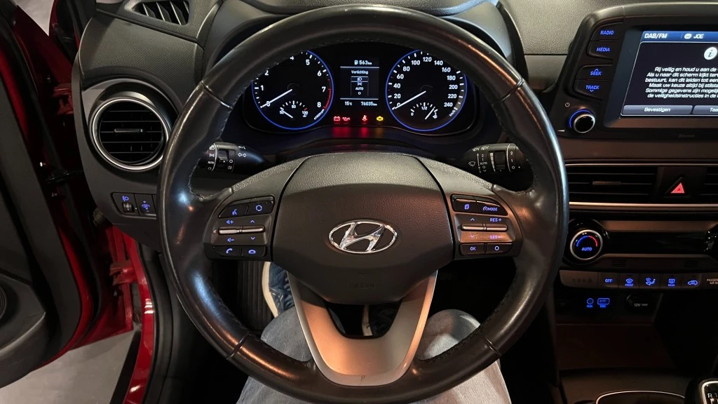 Hyundai Kona – foto 17