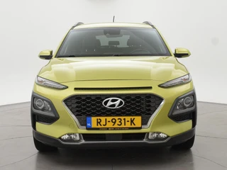 Hyundai Kona – thumbnail 7